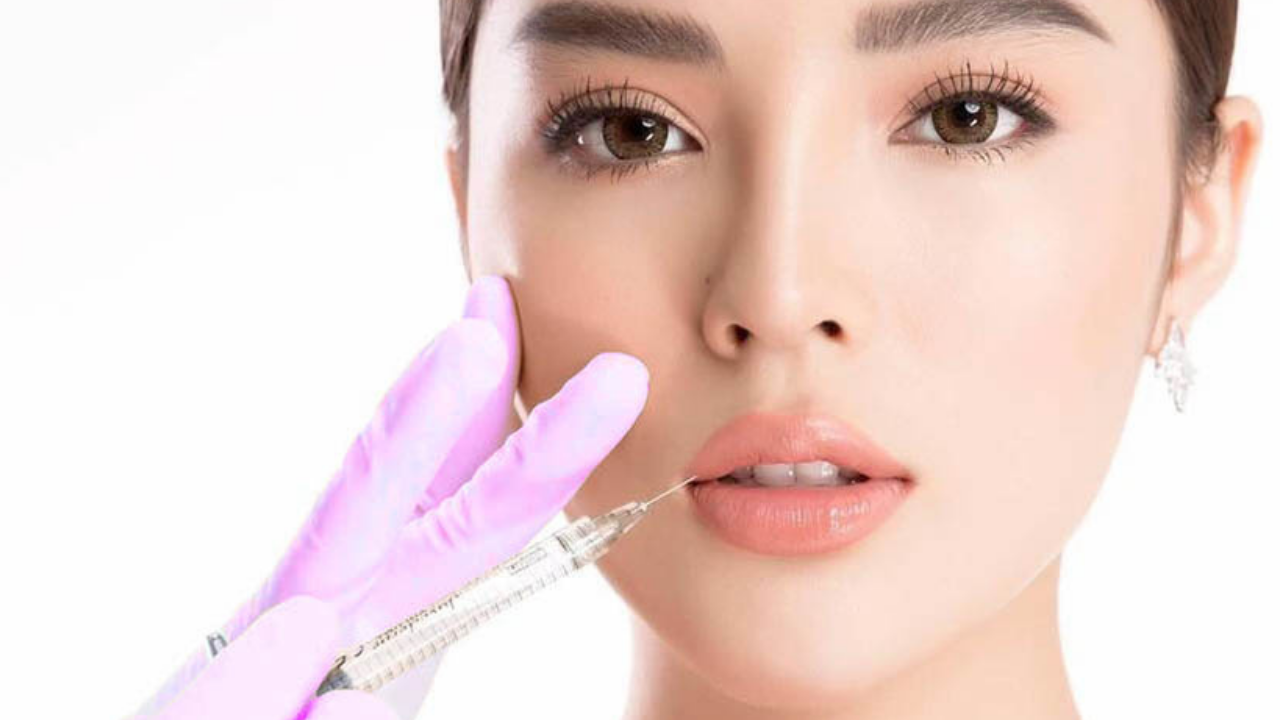 Bác sĩ giải đáp: Có nên tiêm filler môi không?