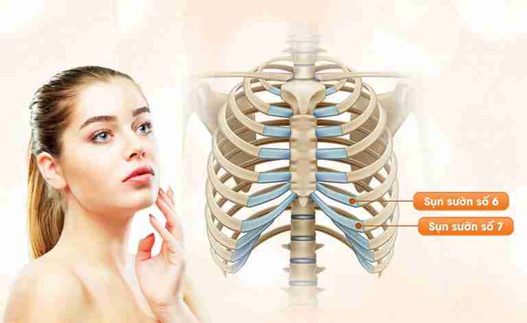 Lấy sụn sườn của người khác để nâng mũi được không
