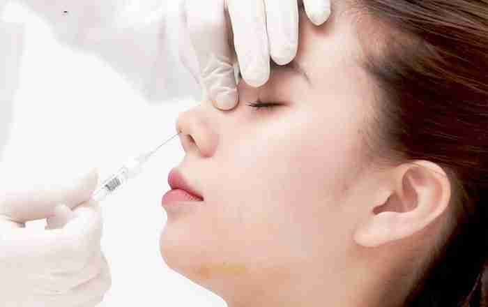 Tiêm filler nâng mũi có đẹp như quảng cáo không?