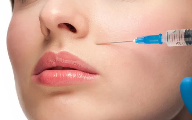 Những điều chưa biết về tiêm filler rãnh cười
