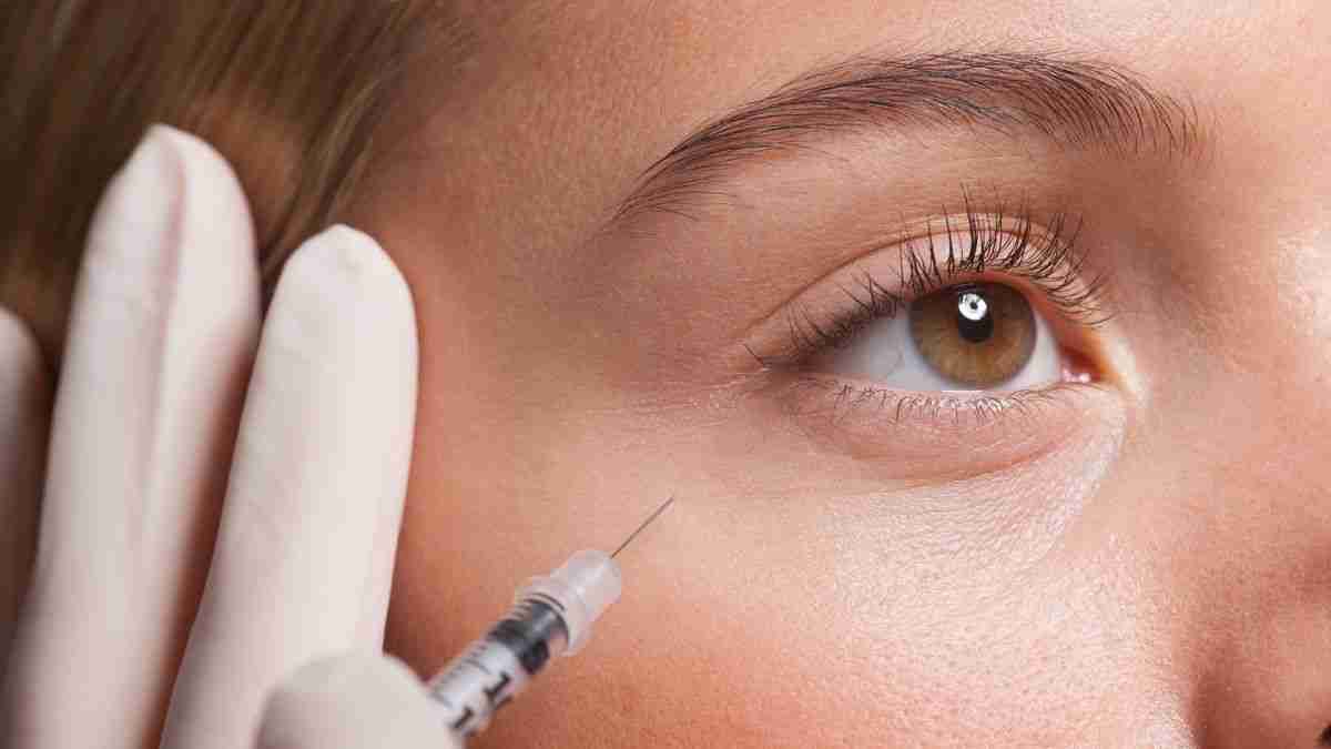 Tiêm xóa nhăn botox: Nên hay không?