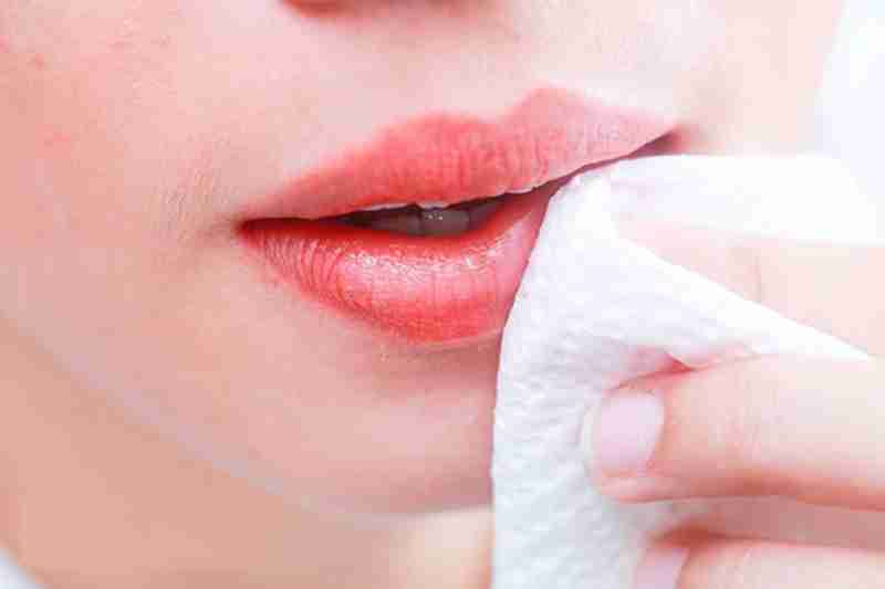 Hướng dẫn vệ sinh môi sau phẫu thuật đúng cách