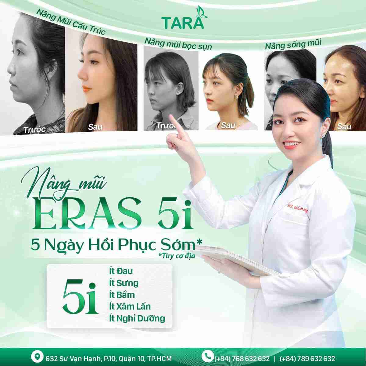 Nâng mũi bọc sụn ERAS 5i