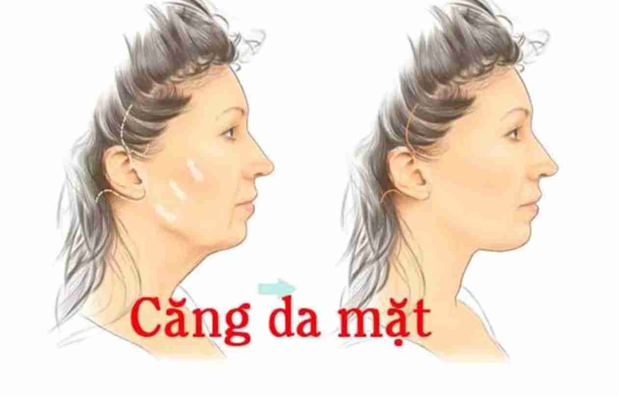 Bác sĩ giải đáp: Căng da mặt toàn phần gây mê hay gây tê?