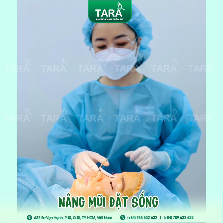 Nâng mũi ERAS 5i: 03 ngày tháo nẹp