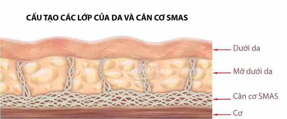 Phẫu thuật căng da mặt toàn phần thực hiện như thế nào?