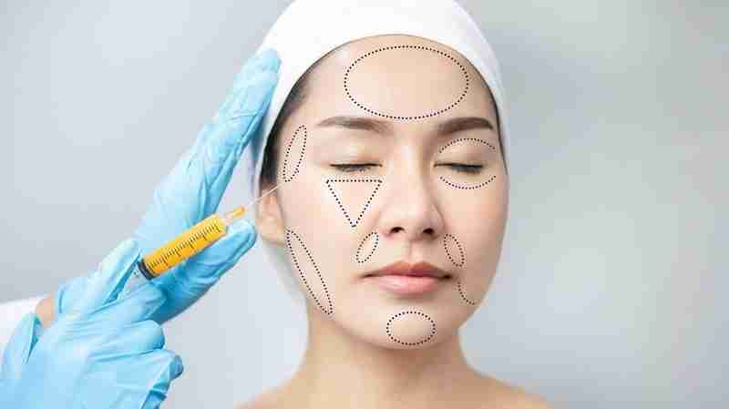 Nên chuẩn bị những gì trước khi cấy mỡ trẻ hóa da?