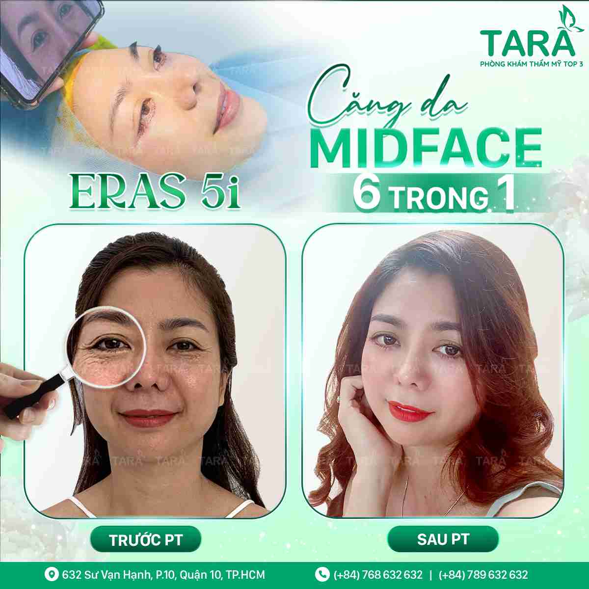 Phẫu thuật căng da mặt tại ở đâu tốt?