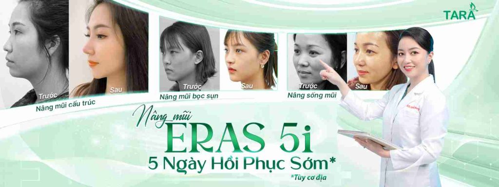 nâng mũi mau lành đẹp bền lâu