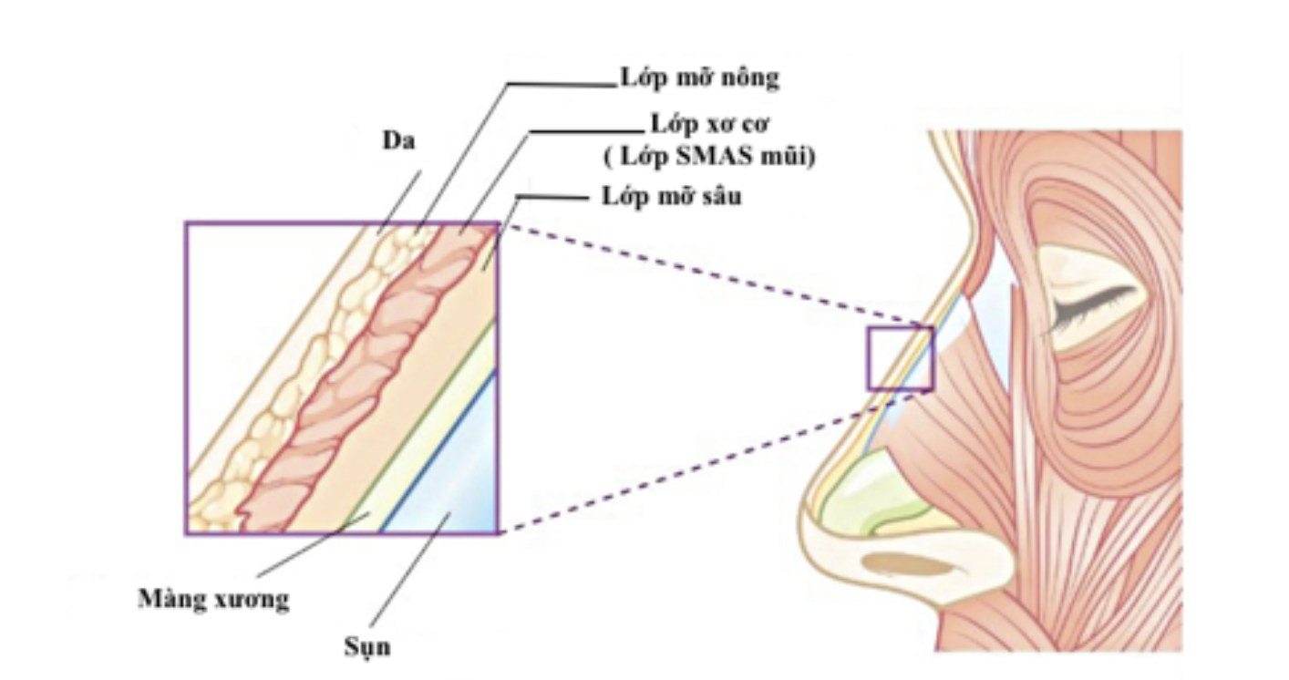 Tổng quan về phương pháp hiện đại nâng mũi siêu vi phẫu