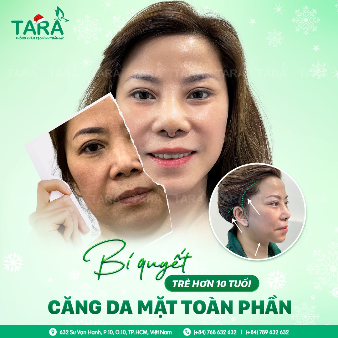Căng da mặt toàn phần ở đâu thì tốt và  tiêu chí lựa chọn