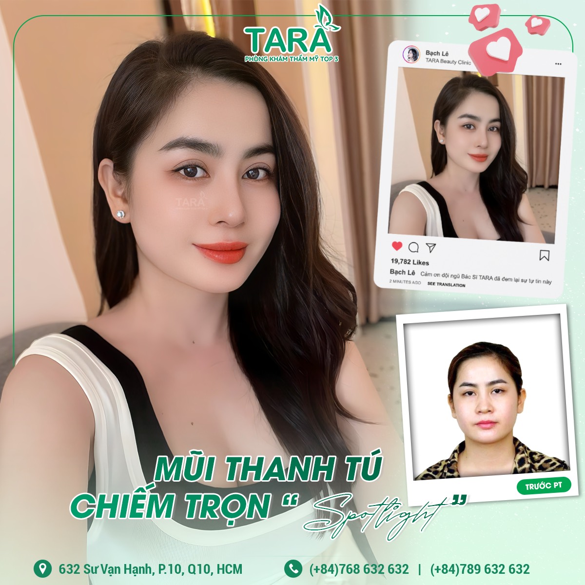 Da mũi mỏng có nâng mũi cấu trúc được không?