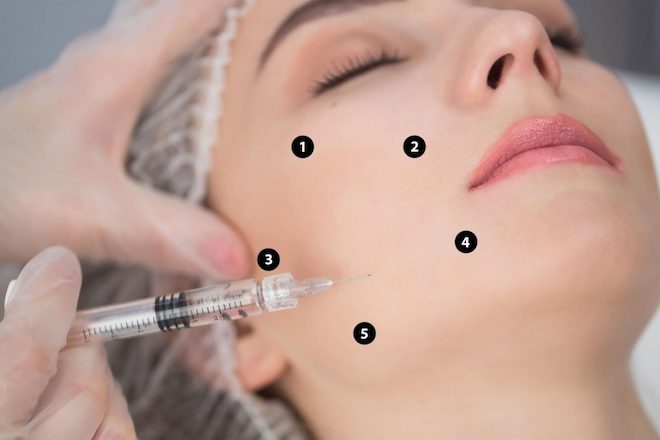 Từ A-Z về tiêm căng bóng trẻ hoá da bằng kỹ thuật tiêm BAP