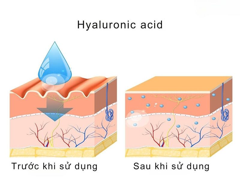 Tiêm căng bóng trẻ hoá da bao nhiêu lần thì tốt?
