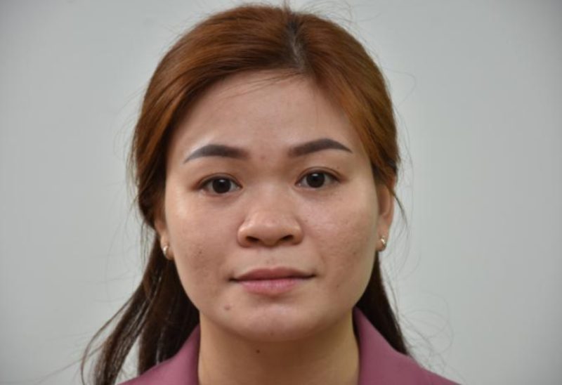 Hiểu về mũi siêu vi phẫu không đau cho người mũi tẹt