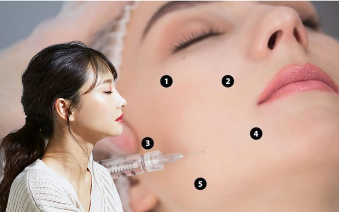 Mở khoá từ điển tiêm BAP trẻ hoá da