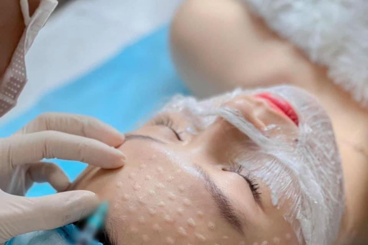 Các phương pháp trẻ hoá da không phẫu thuật hiện nay