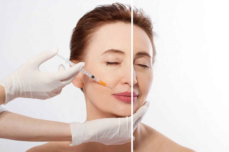 Tiêm trẻ hoá xong đi làm ngay được không và lưu ý quan trọng