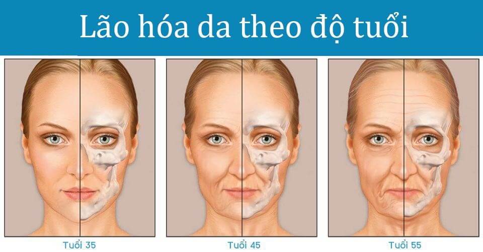 Căng da mặt nội soi là gì? Thực hiện như thế nào?
