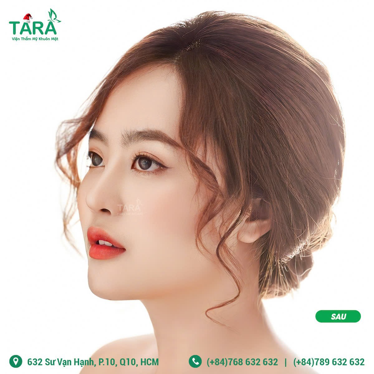 Nâng mũi siêu vi phẫu có để lại sẹo không?