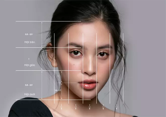 Tiêm filler tạo hình khuôn mặt có giữ được lâu không?
