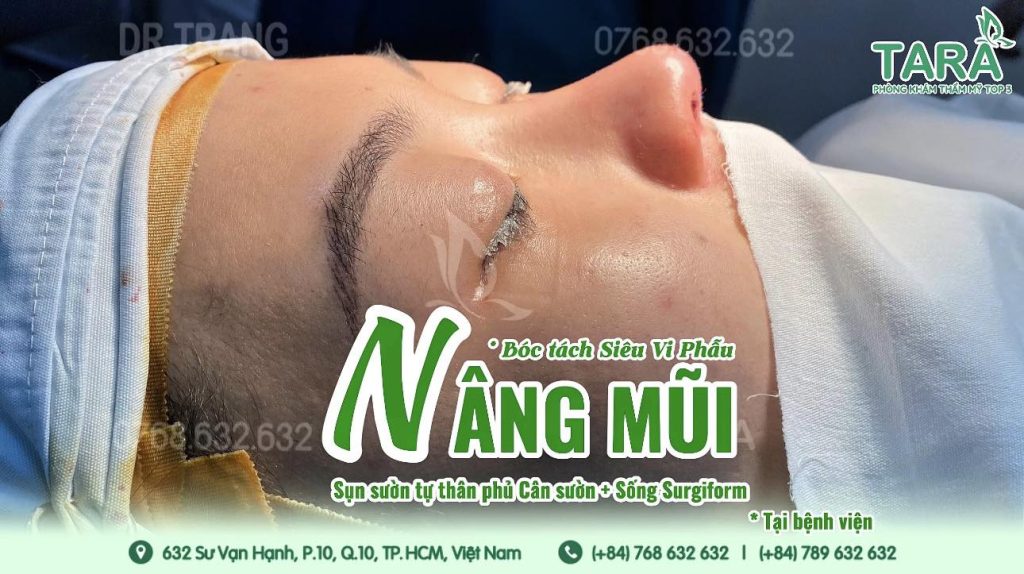 10+ câu hỏi “vàng” cần hỏi bác sĩ trước khi nâng mũi siêu vi phẫu