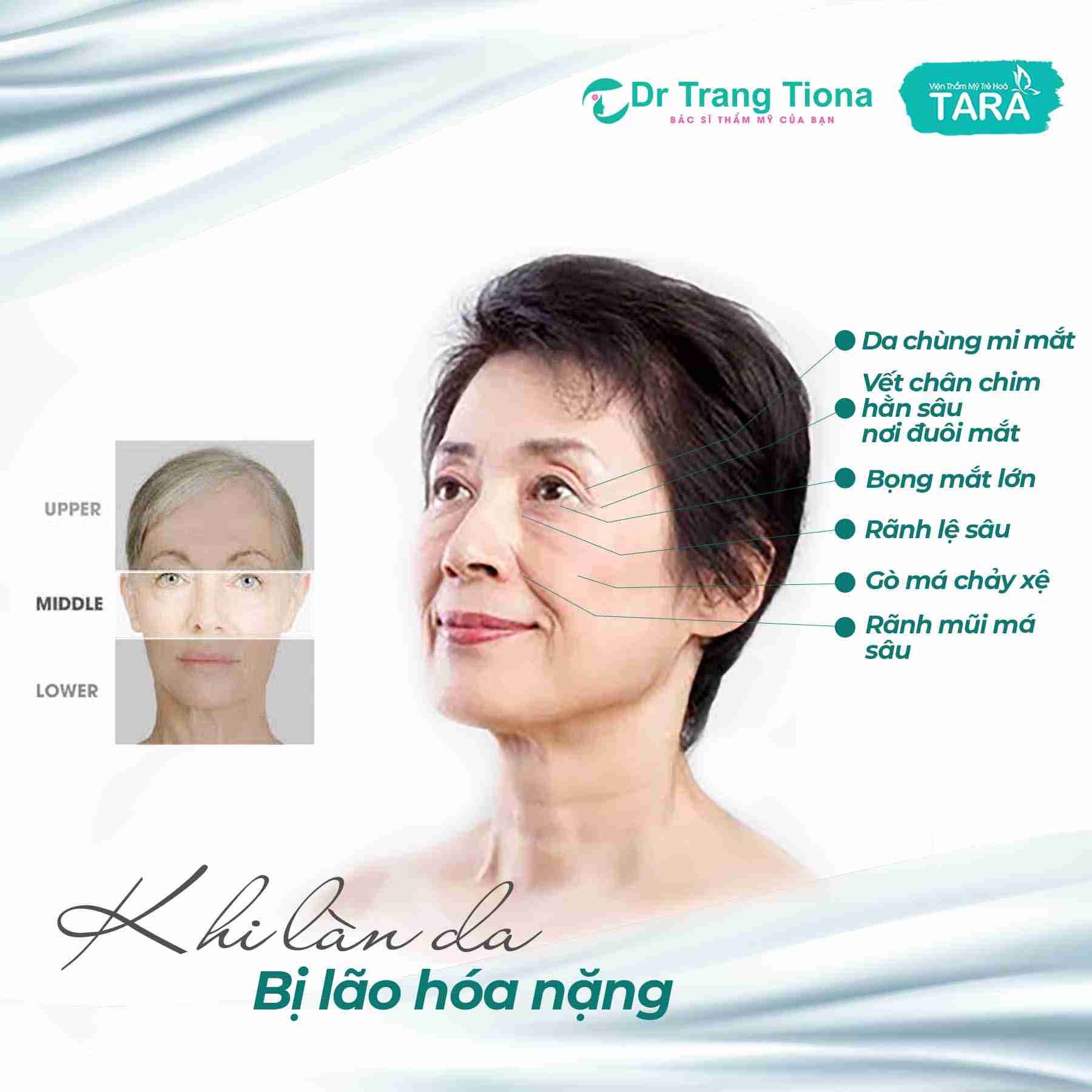 Ai không nên thực hiện căng da mặt Midface? Tại sao?