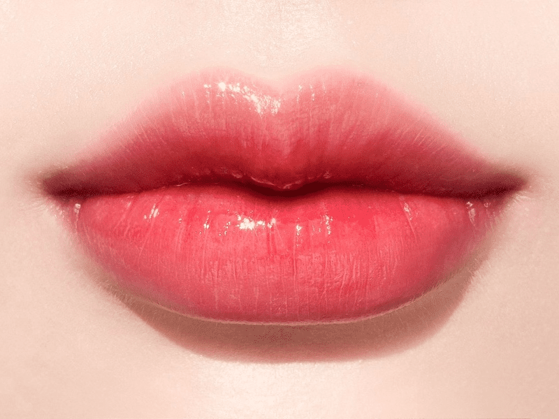 Bác sĩ giải đáp: Có nên tiêm filler môi không?