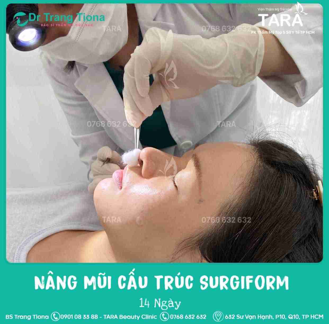 Bác sĩ giải đáp: Sửa mũi bao lâu thì đẹp tự nhiên?