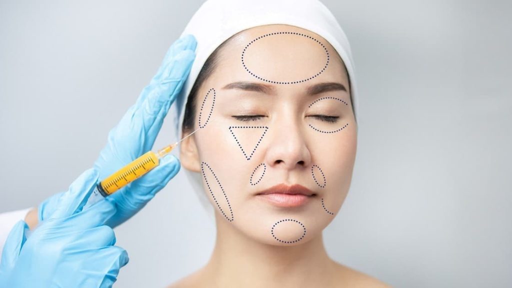Cấy mỡ mặt có an toàn không? Biến chứng nào cần lưu ý?