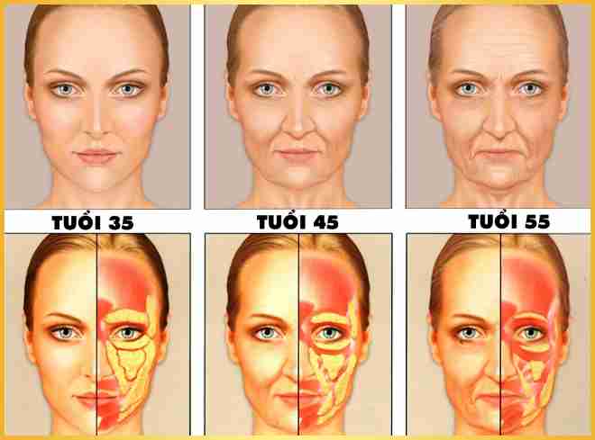 Cấy mỡ mặt làm đầy má hõm: Bí quyết cho gương mặt đầy đặn