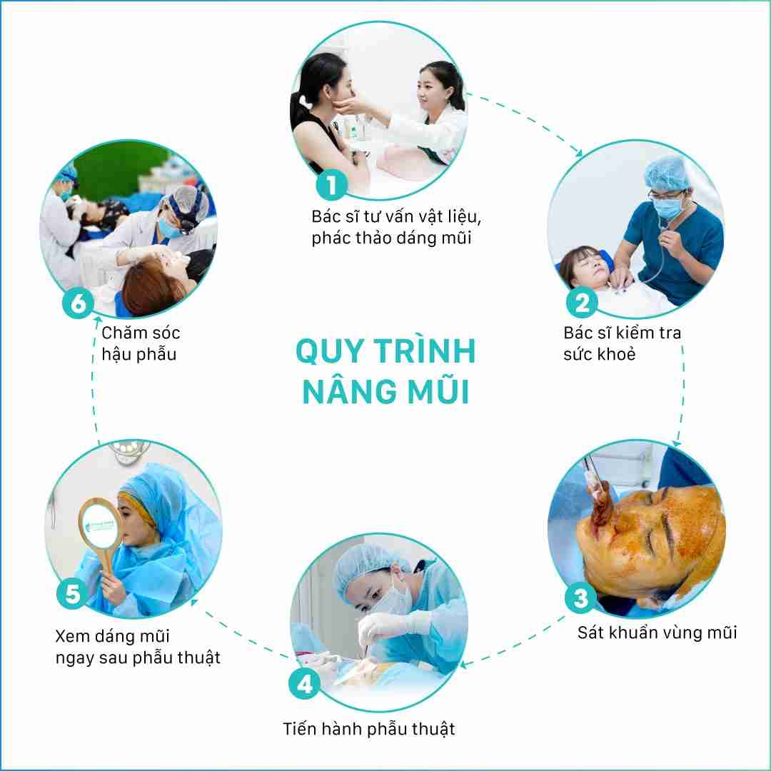 Tại sao nâng mũi đặt sống được nhiều chị em lựa chọn?