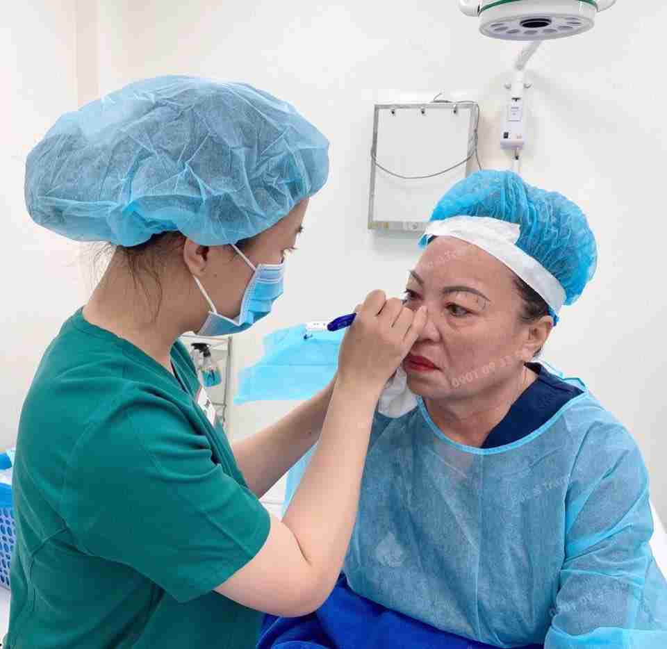 Khắc phục da chảy xệ vùng mặt nhờ căng da Midface