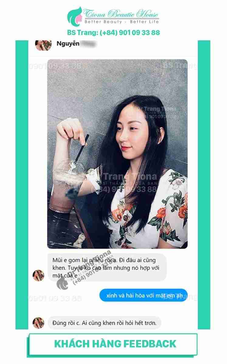 Mũi diều hâu hay mũi két là gì? Có nên sửa hay không?