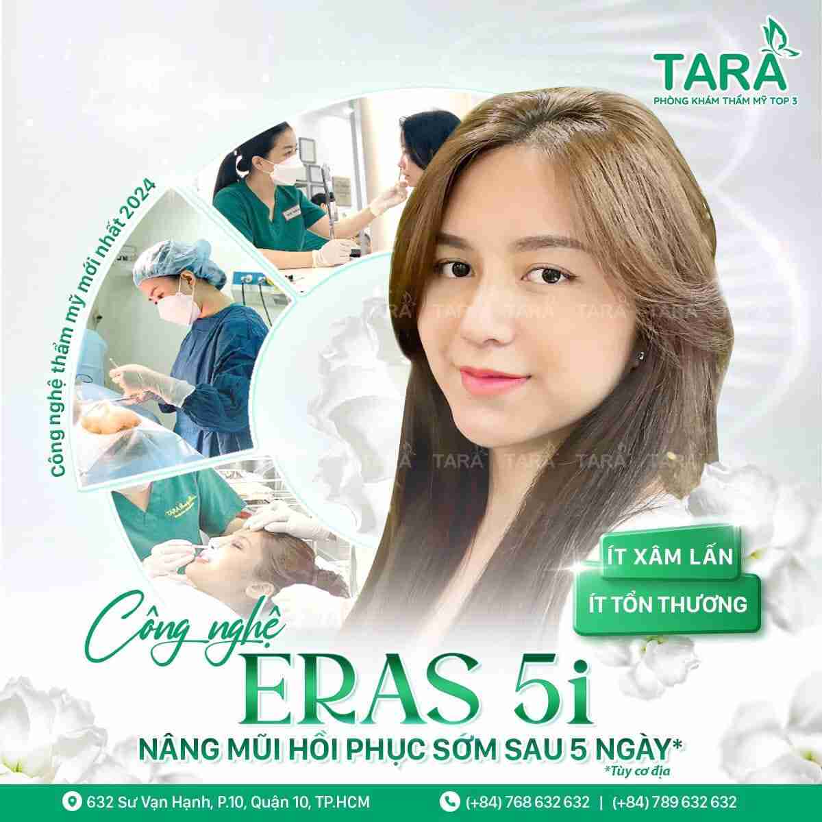 Nâng mũi sụn tự thân là gì? Có nên nâng mũi bằng sụn tự thân không?