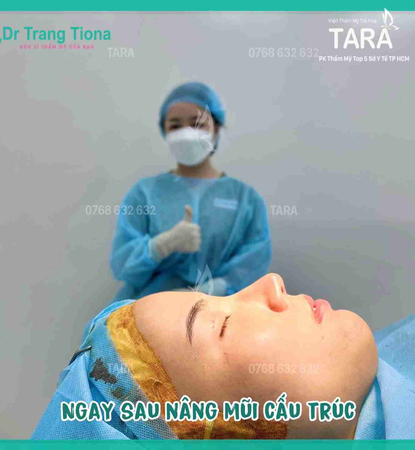 Nâng mũi cấu trúc có đắt không? Giá bao nhiêu?