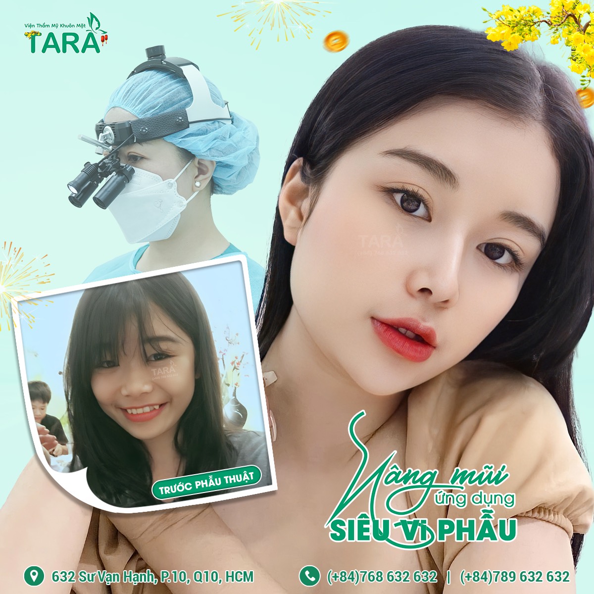Nâng mũi ứng dụng đeo kính lúp siêu vi phẫu tại Sài Gòn: Địa chỉ uy nào uy tín?