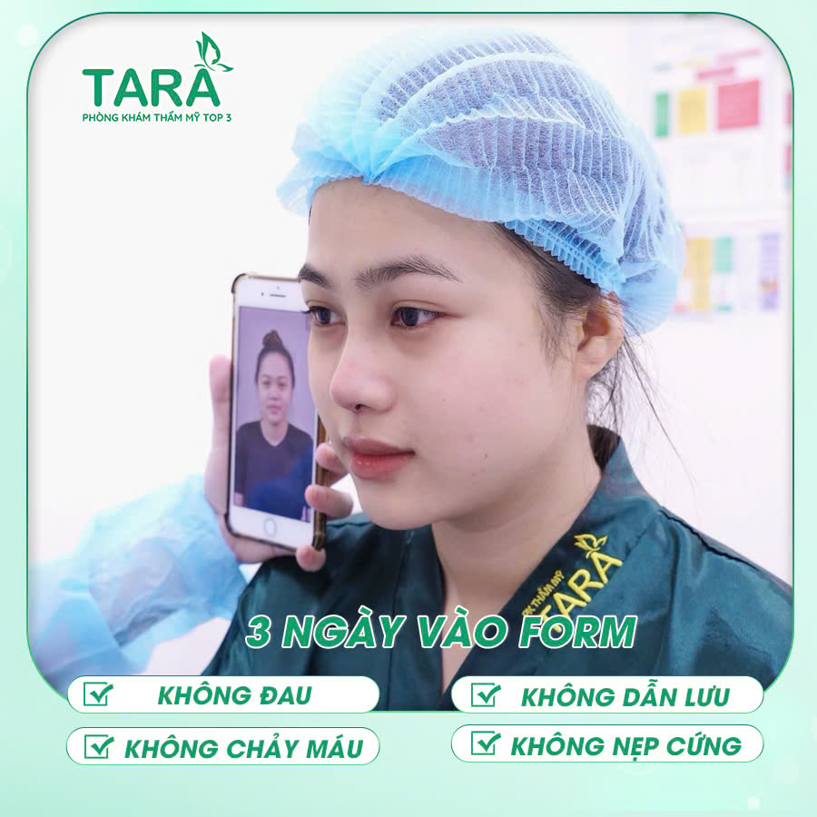 Tại sao nâng mũi ứng dụng đeo kính lúp siêu vi phẫu lại không đau?