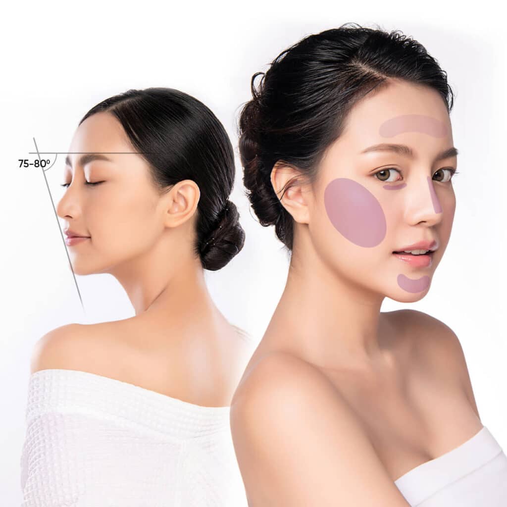Tiêm fullface khác gì với việc chỉ tiêm từng vùng lẻ?
