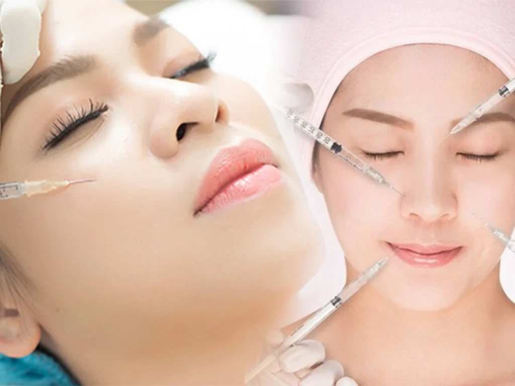 Tiêm fullface trước Tết: nên làm trước bao lâu để tự tin đi chơi?