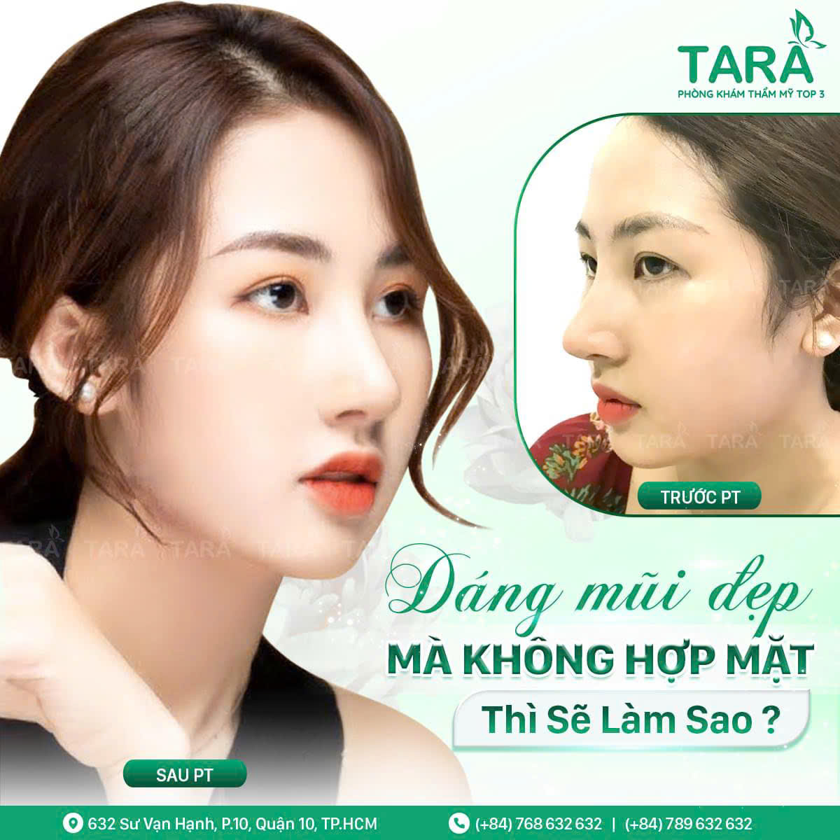 Bác sĩ nâng mũi đẹp uy tín tại TPHCM – Bác sĩ Trang Thẩm mỹ TARA