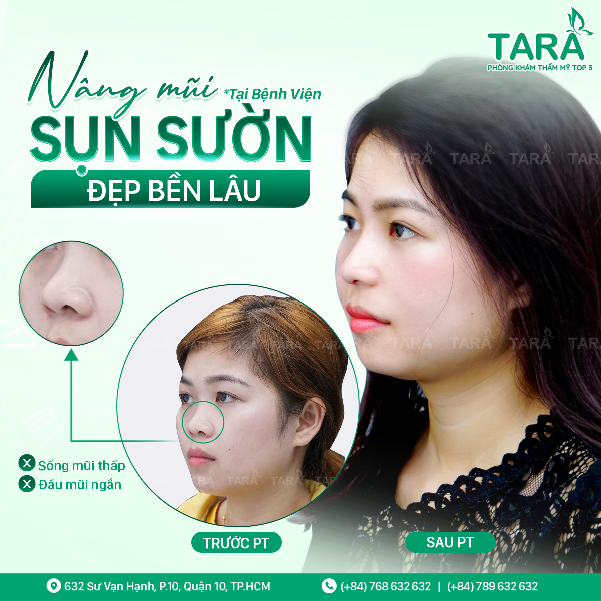 Địa chỉ nâng mũi đẹp uy tín tại TP HCM – Tiến sĩ Bác sĩ Trang Thẩm mỹ TARA – Dr Trang TARA