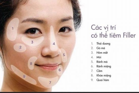 Top 5 địa chỉ tiêm thẩm mỹ filler HA uy tín, giá phải chăng