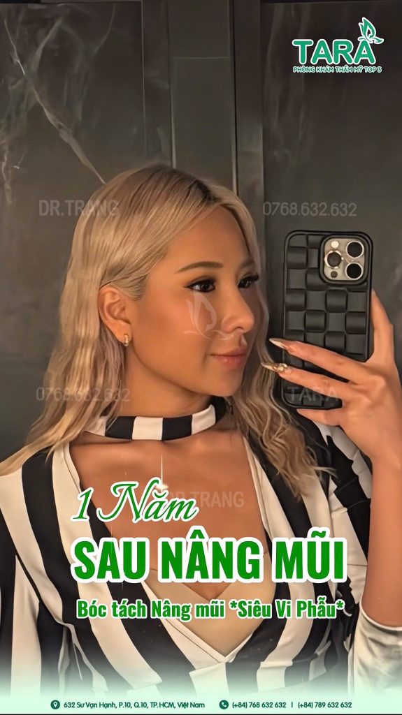 Vừa nâng mũi siêu vi phẫu vừa cấy mỡ mặt, có được không?