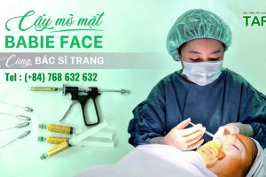 Cấy Mỡ Mặt Baby Face