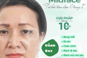 Căng da MIDFACE – Phẫu thuật trẻ hoá tầng mặt giữa ít xâm lấn hiệu qủa nhất hiện nay