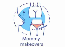 Mommy Makeover Giải Pháp Làm Đẹp Cho Mẹ Sau Sinh