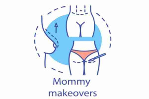 Mommy Makeover Giải Pháp Làm Đẹp Cho Mẹ Sau Sinh