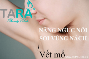 Vì sao nên nâng ngực nội soi đường nách?