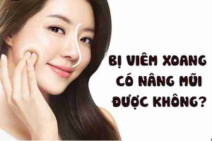 Bị viêm xoang có nâng mũi L-line được không?